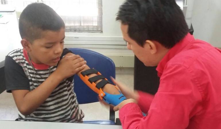 Se conoció en Neiva, la primera prótesis 3D creada con materiales de bajo costo