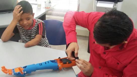 Se conoció en Neiva, la primera prótesis 3D creada con materiales de bajo costo Se conoció en Neiva, la primera prótesis 3D creada con materiales de bajo costo