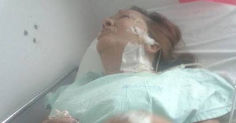 Mujer atacada por perro pit bull en Antioquia.