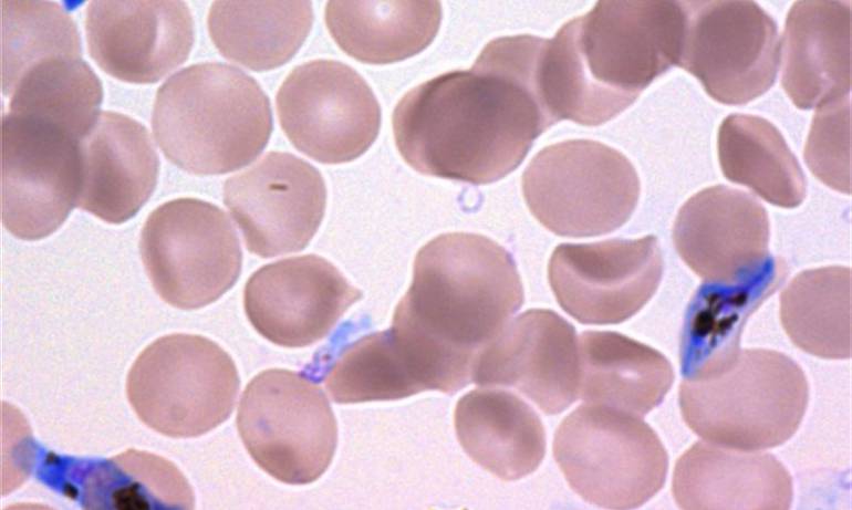 Alerta por posible brote de malaria entre indígenas en Antioquia