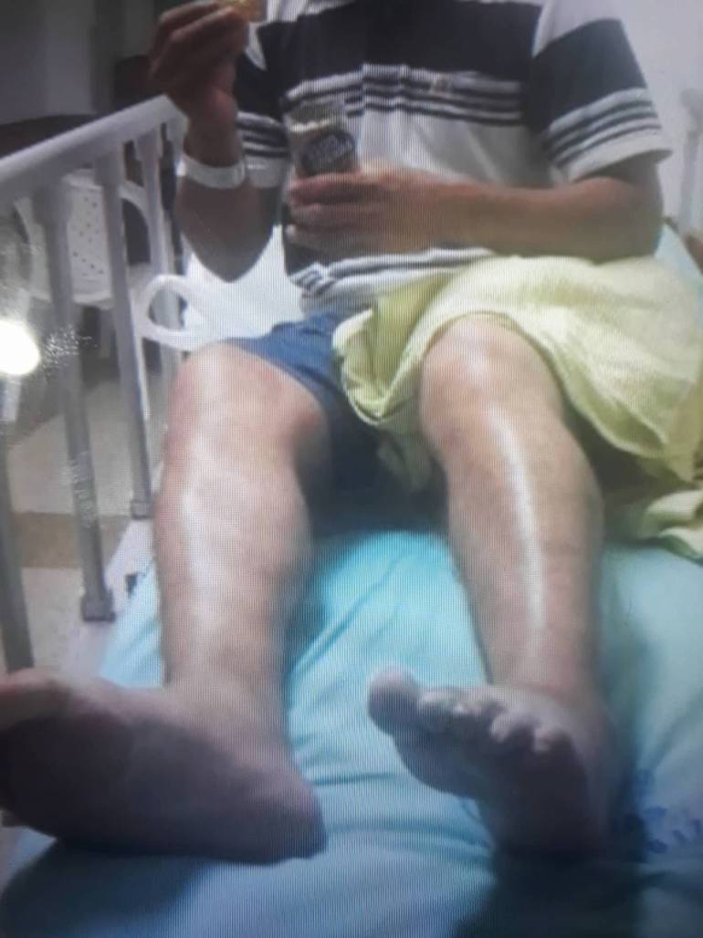 Borracho se lanza desde tercer piso para seguir consumiendo licor