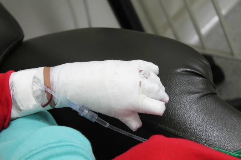 Van 13 personas quemadas con pólvora en Antioquia en lo corrido de diciembre