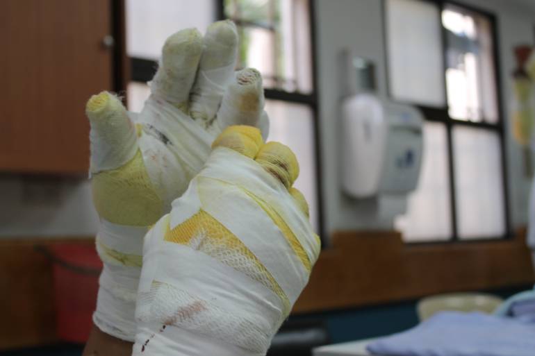 MEDELLÍN, REDUCCIÓN, 50%, LESIONADOS, PÓLVORA: Medellín reporta reducción en un 50% en lesionados con pólvora