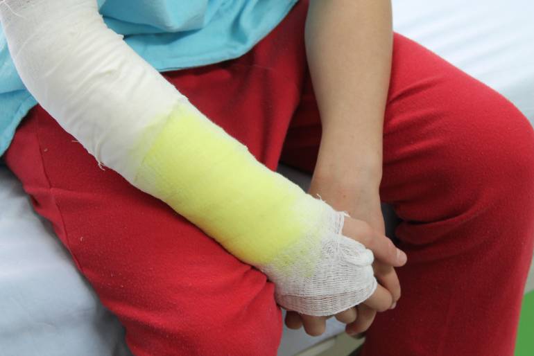 Aumenta cifra de quemados con pólvora en el país Aumenta cifra de quemados con pólvora en el país