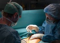 Alarma en autoridades de salud de Cali por primer caso de muerte por cirugía plástica en 2018