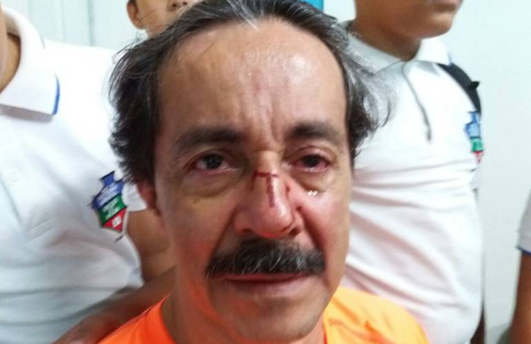 Puños a profesor: Profesor del Politécnico fue atacado a puños y patadas frente a estudiantes