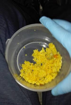 Intoxicación masiva en Soacha por consumo de alimentos en mal estado Intoxicación masiva en Soacha por consumo de alimentos en mal estado