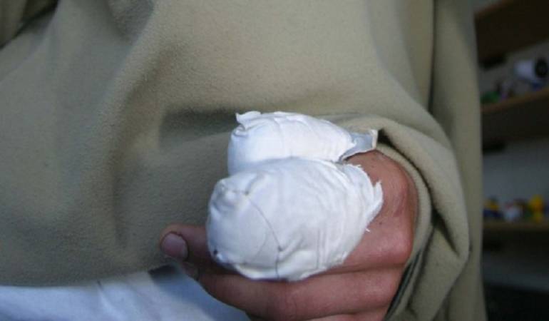 Persona Quemada