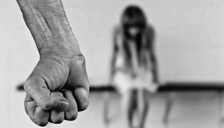 MUJER ATACADA CON ÁCIDO MEDELLÍN: Una mujer de 35 años fue atacada con ácido en Medellín