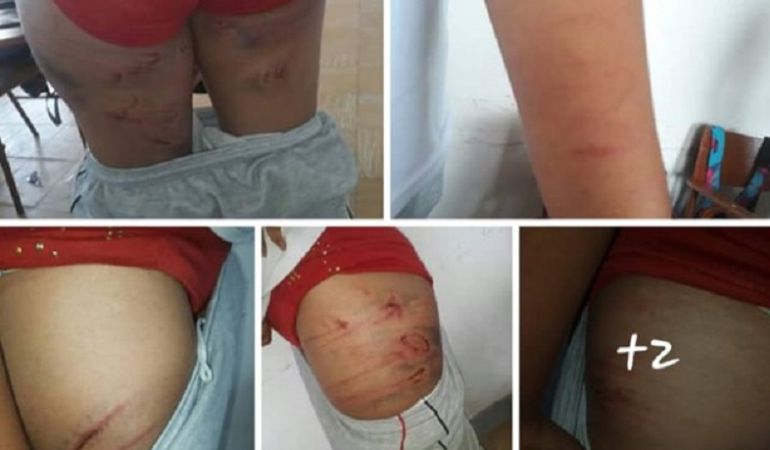 Polémica en Risaralda por brutal agresión de una madre a su hija: Polémica en Risaralda por brutal agresión de una madre a su hija