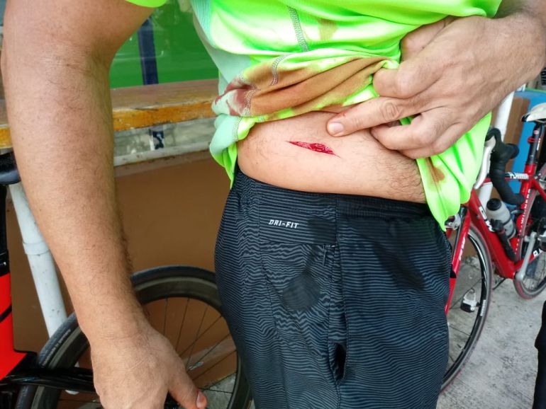 Inseguridad en Cartagena: Denuncian ola de atracos en parque lineal de Crespo, en Cartagena