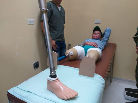 SUR DE BOLÍVAR BUCARAMANGA: Con nuevas prótesis, Diego ya camina SUR DE BOLÍVAR BUCARAMANGA: Con nuevas prótesis, Diego ya camina