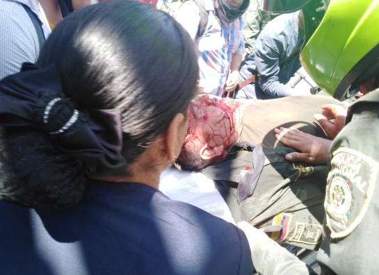 Protestas Estudiantes Policías en Neiva: Un policía gravemente herido durante manifestaciones en Neiva Protestas Estudiantes Policías en Neiva: Un policía gravemente herido durante manifestaciones en Neiva