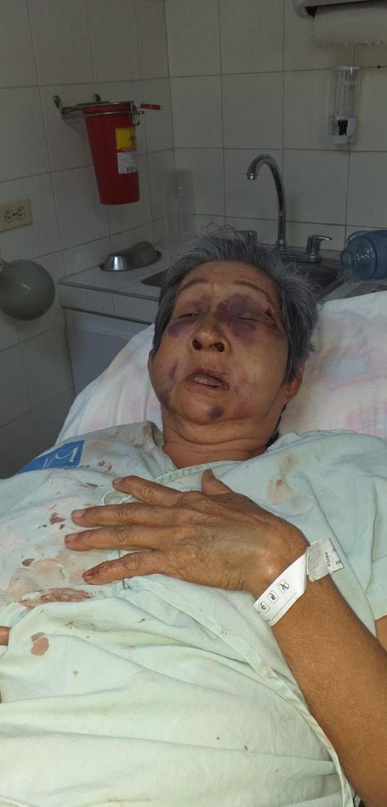 RAPONAZO ADULTA MAYOR GRAVE ESTADO DE SALUD BUCARAMANGA: VIDEO: Adulta mayor en grave estado de salud tras raponazo RAPONAZO ADULTA MAYOR GRAVE ESTADO DE SALUD BUCARAMANGA: VIDEO: Adulta mayor en grave estado de salud tras raponazo