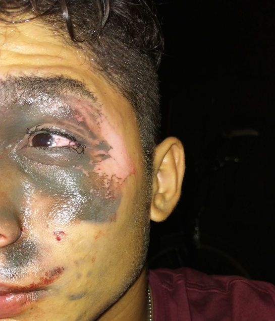 Estudiante lastimado Estudiante lastimado