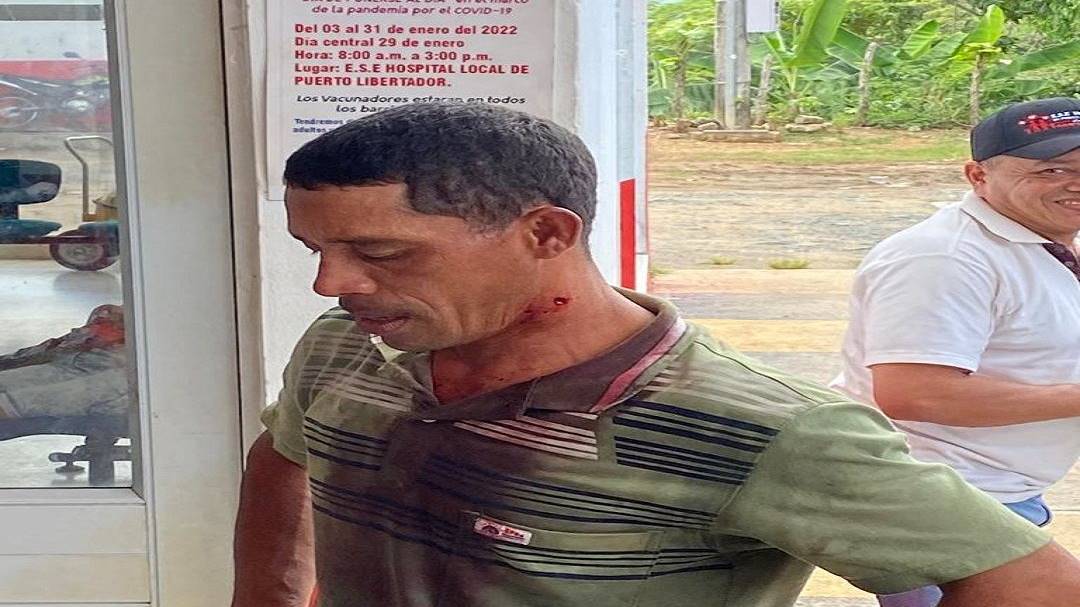 Campesinos resultaron heridos en enfrentamientos con la Policía en el sur de Córdoba