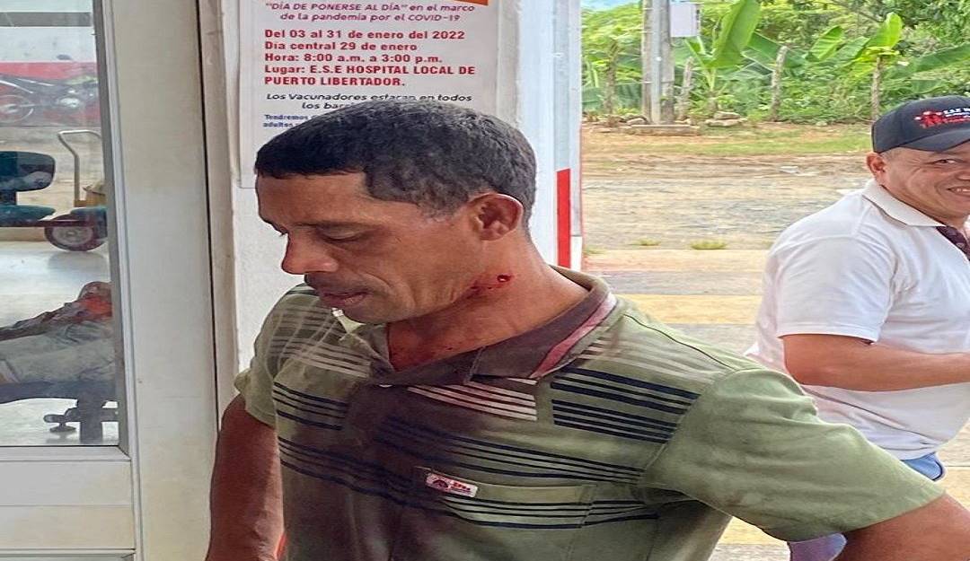 Persona herida en enfrentamientos de campesinos con policías. Persona herida en enfrentamientos de campesinos con policías.