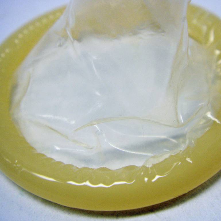 Alergia al semen