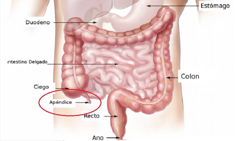 Lo Más Caracol 02 de Febrero 2017: Síntomas para identificar una apendicitis aguda