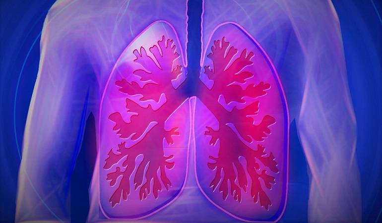 Lo Más Caracol 07 de Febrero 2017: Cómo hacer una limpieza efectiva de sus pulmones