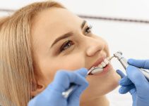Blanqueamiento dental: con los dientes no se juega