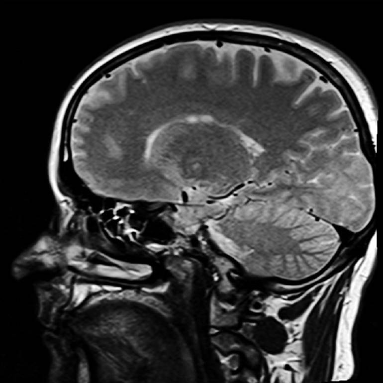 ¿Para qué sirven las imágenes diagnósticas especializadas?