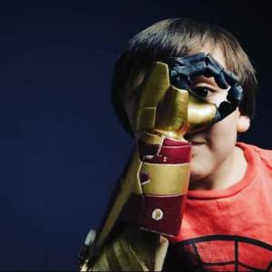 Las prótesis que hacen felices a cientos de niños y niñas Las prótesis que hacen felices a cientos de niños y niñas