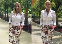 Esclerodermia, la enfermedad que cambió la vida de Manuela Estévez