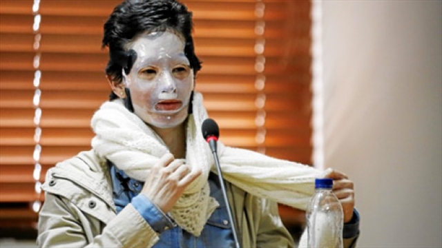 Este martes se reanudará juicio a Jonathan Vega por la agresión con ácido