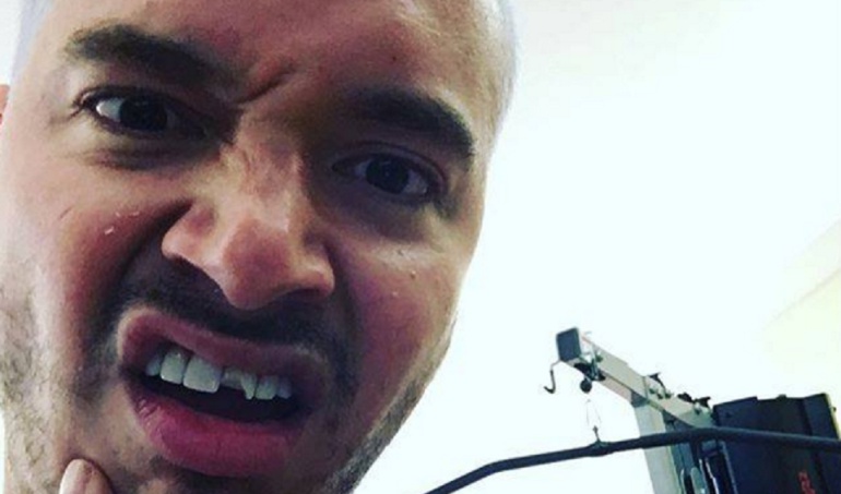 Fotos De J Balvin 2016 | j balvin j balvin se quiebra un diente y genera una nueva Fotos De J Balvin 2016 | j balvin j balvin se quiebra un diente y genera una nueva