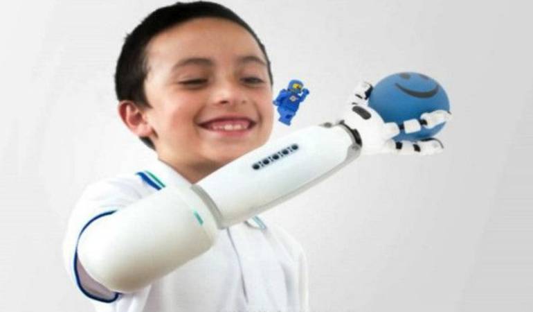 Brazo protésico hecho con piezas de lego: Colombiano diseña brazo protésico para niños con piezas de Lego