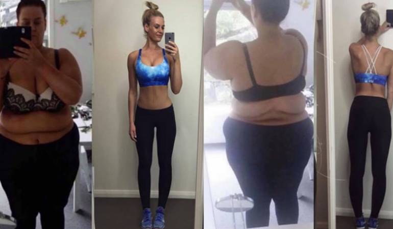 Transformación de mujer que bajó 88 kilos, Mujer adelgaza 88 kilos y lo comparte en redes sociales: La mujer que documentó en Instagram cómo perdió 88 kilos en 20 meses