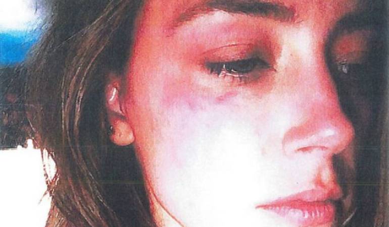 Johnny Depp acusado de golpear a su esposa: Dictan orden de restricción a Johnny Depp por violencia doméstica