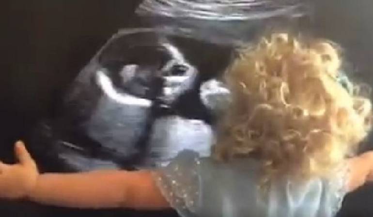 Niña se emociona cuando conoce la ecografía de su hermana: Bebé se emociona al ver la ecografía de su hermana