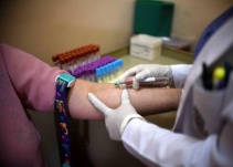 La epidemia de zika ya no constituye una emergencia sanitaria internacional