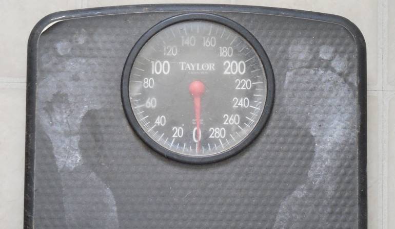 Anorexia: La nueva esperanza para una mujer que pesa 20 kilos por causa de la anorexia