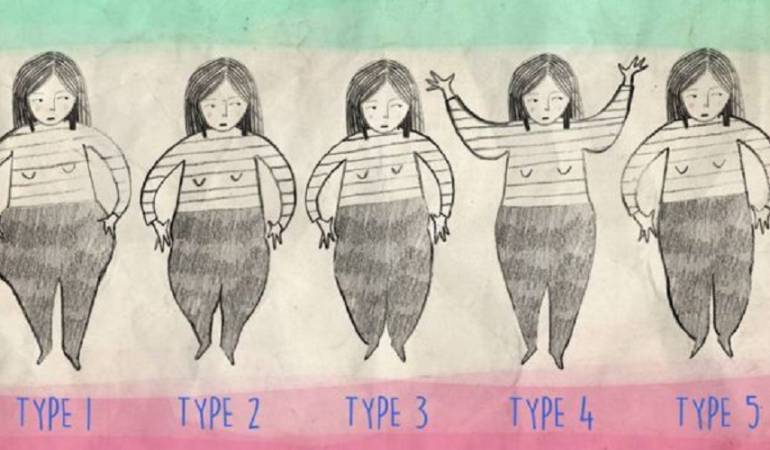 Cinco tipos de lipedema.