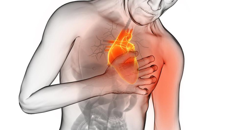 ¿Cómo reacciona el corazón ante un infarto?: ¿Cómo reacciona el corazón ante un infarto?