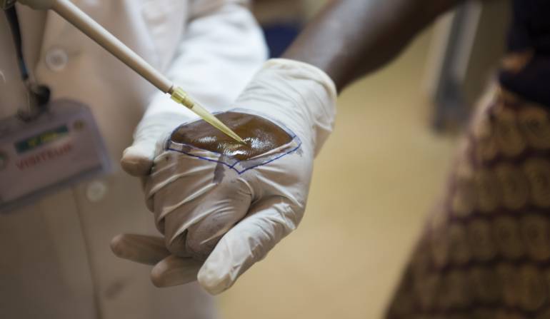 Malaria se dispara en Venezuela y Colombia: OMS dice que malaria se dispara en Venezuela y Colombia por razones distintas