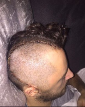 Ryan Mason Ryan Mason
