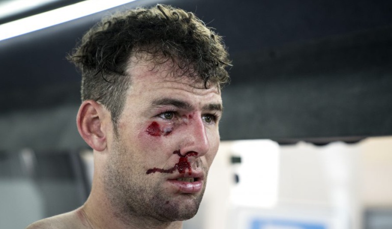 Cavendish Tirreno-Adriático abandono: Cavendish abandona la Tirreno-Adriático por una fractura de costilla