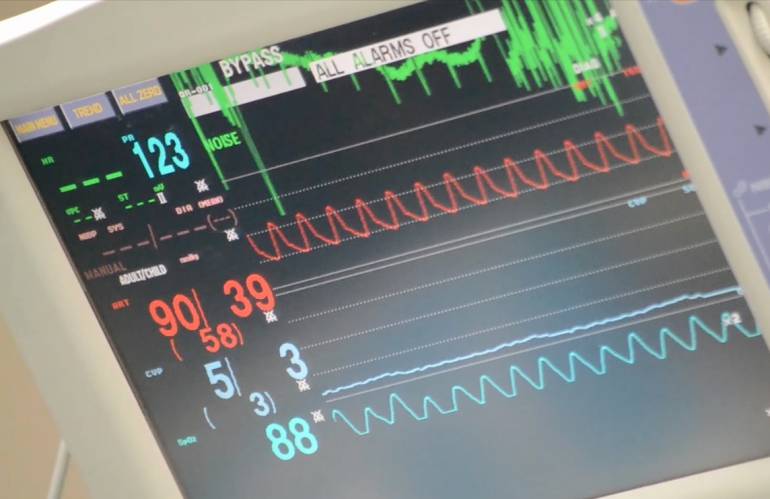 Infartos: 60.000 personas mueren al año por enfermedades del corazón en Colombia
