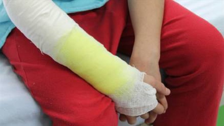 Quemados menores de edad Villavicencio: Avanza recuperación de niña quemada con aceite caliente por su padre