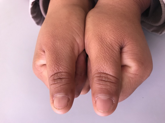 Caminantes venezolanos: En Colombia por zapatos, la lucha de las mamás venezolanas Caminantes venezolanos: En Colombia por zapatos, la lucha de las mamás venezolanas