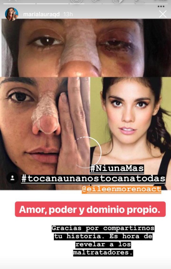 Eileen Moreno: #NiUnaMás: Rechazo e indignación por golpiza a Eileen Moreno Eileen Moreno: #NiUnaMás: Rechazo e indignación por golpiza a Eileen Moreno
