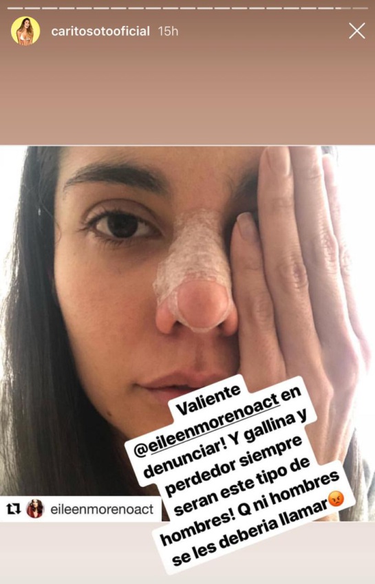 Eileen Moreno: #NiUnaMás: Rechazo e indignación por golpiza a Eileen Moreno Eileen Moreno: #NiUnaMás: Rechazo e indignación por golpiza a Eileen Moreno
