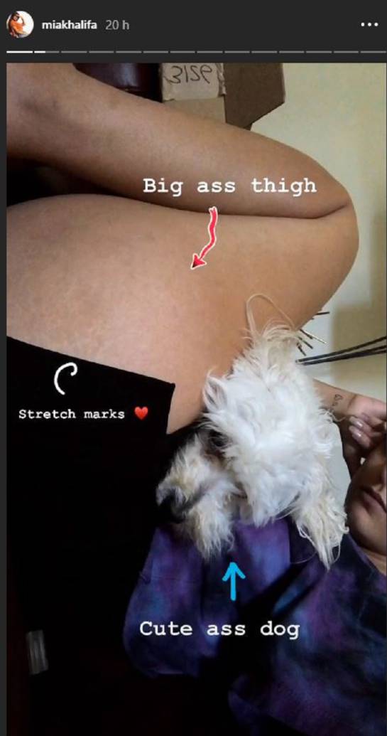 Las estrías de Mia Khalifa: ¡Sin vergüenza! Mia Khalifa muestra sus estrías Las estrías de Mia Khalifa: ¡Sin vergüenza! Mia Khalifa muestra sus estrías
