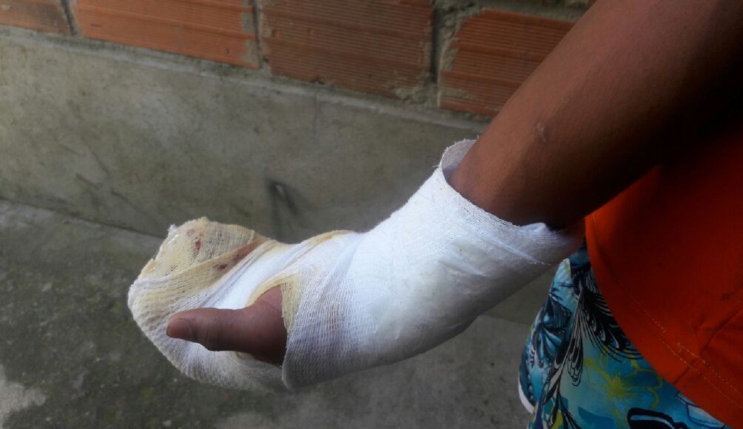 Quemados con pólvora en Cúcuta: Tres personas quemadas con pólvora en Norte de Santander