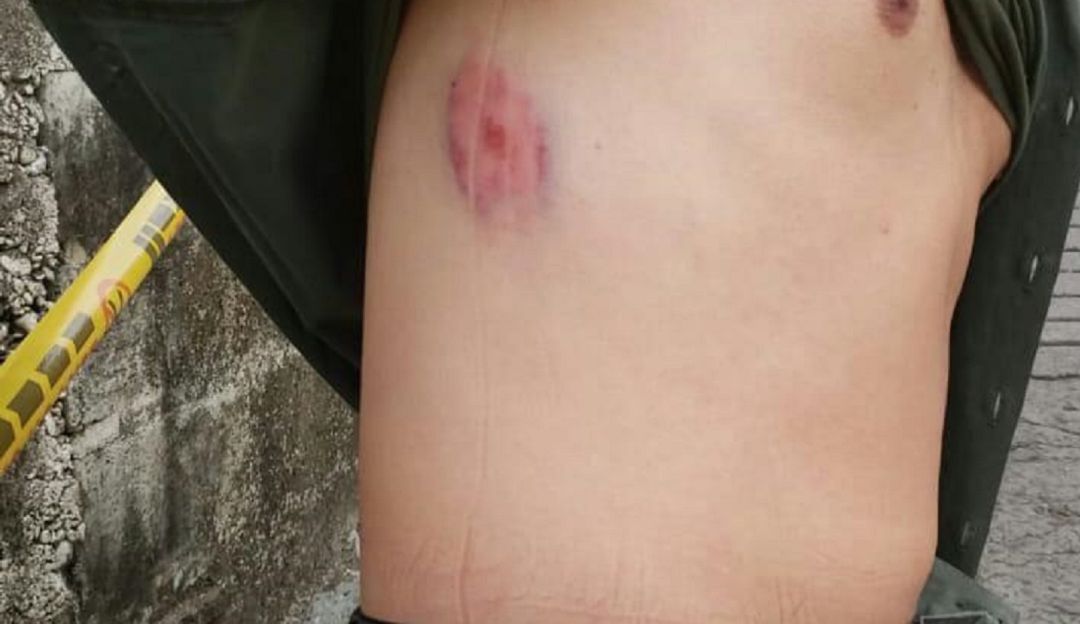 POLICÌA, ANZÀ: Un policía fue atacado por un hombre borracho en Anzá, Antioquia