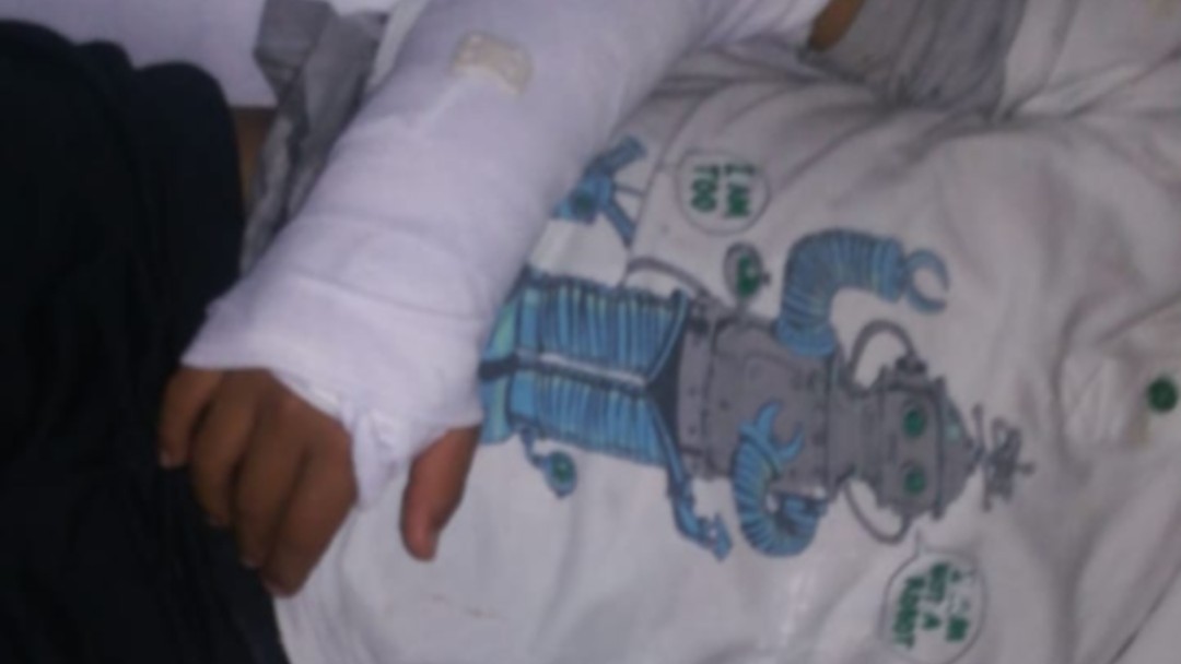 Niño se accidentó en el parque del Agua y no había póliza vigente